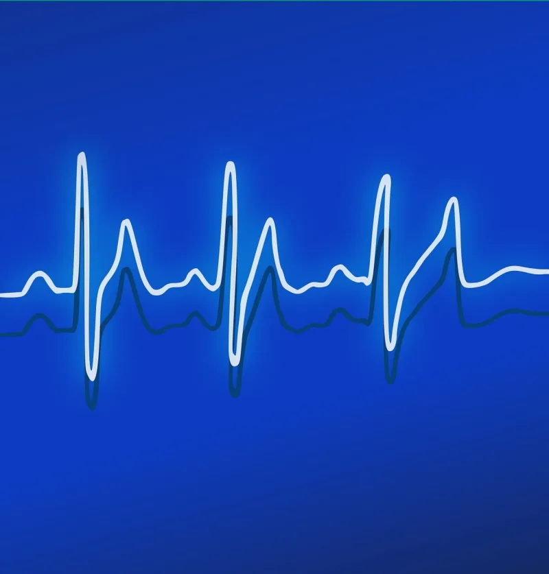 Ekg Heartbeat Frequency Stickdatei – Natur