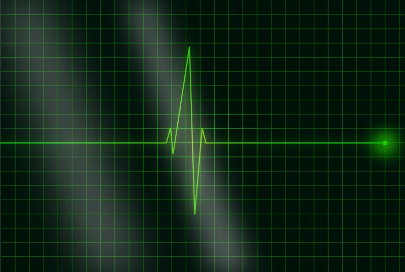 Electrocardiogram Ecg Heartbeat Stickdatei – Natur